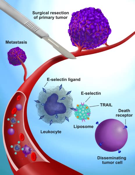 Cellular Soldiers Designed To Kill Cancer Cells That Get Loose During