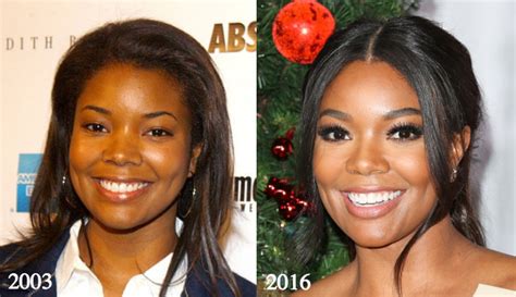 Gabrielle Union Nose Job Rumors Before And After Latest Plastic Surgery Gossip And News