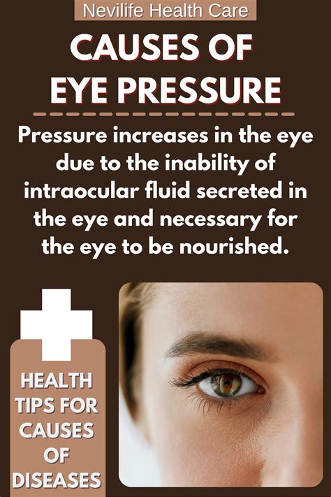 Causes Of Eye Pressure In 2021 Eye Health Health Guide Health Tips