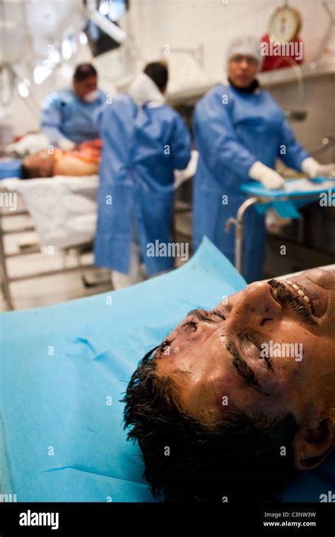 Autopsies Hi Res Stock Photography And Images Alamy