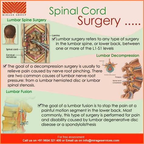 Types Of Lumbar Spine Surgery Design Talk