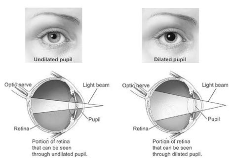 Dilated And Undilated Pupil Eye Health Pupil The Retina
