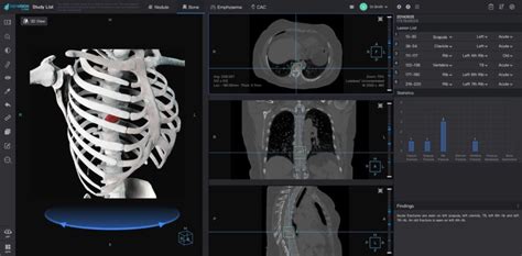 Deep Learning Technology To Assist Medical Image Diagnosis Ai Blog