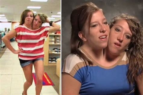 Abby And Brittany Hensel Now What Are The World S Most Famous Conjoined Twins Up To In