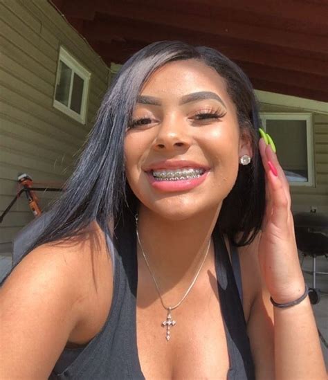 Follow Nikeg0ld For More Bomb Pins 🤩 Cute Braces Colors Cute Baddies With Braces Baddie