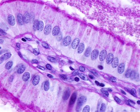 Best Columnar Epithelium Stock Photos Pictures And Royalty Free Images