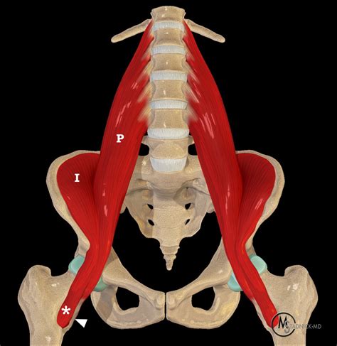 Iliopsoas Tendinopathy Radsource