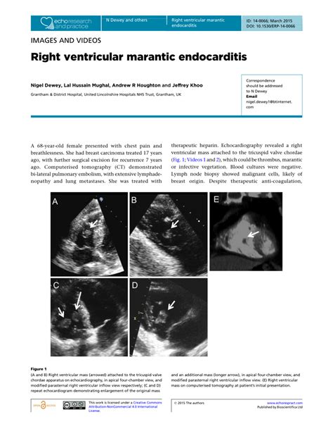 Pdf Right Ventricular Marantic Endocarditis