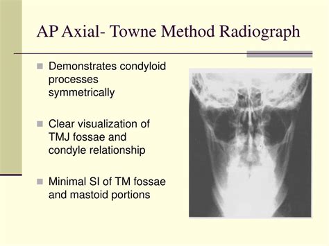 Ppt Mandible And Tmj Lecture Powerpoint Presentation Free Download