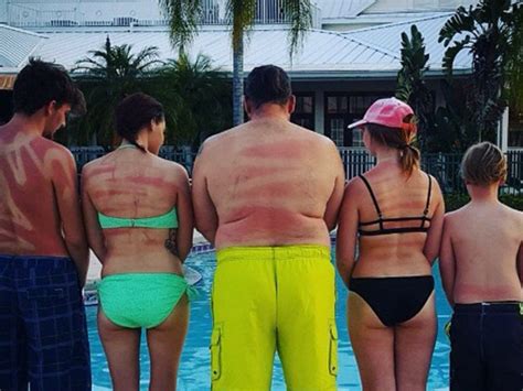These People Used Spray On Sunscreen Incorrectly And Their Tan Lines