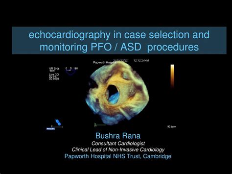 Ppt Echocardiography In Case Selection And Monitoring Pfo Asd
