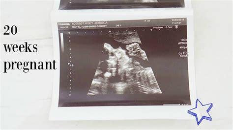 20 Weeks Pregnant Scan Gender And Symptoms Youtube