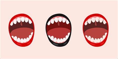 Set Of Open Mouths With Broken And Healthy Teeth Vector Flat
