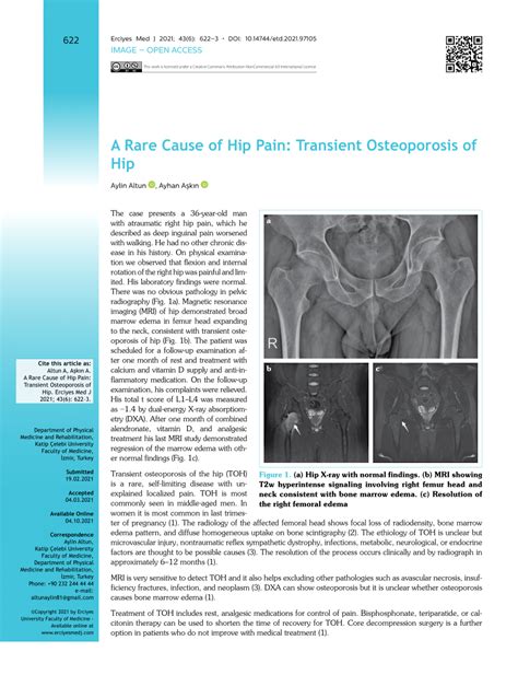 Pdf A Rare Cause Of Hip Pain Transient Osteoporosis Of Hip