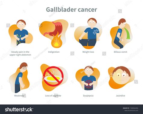 Gallbladder Cancer Signs Symptoms Infographic Sign Stock Illustration