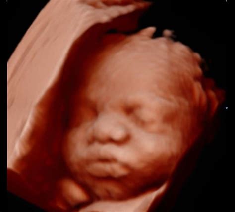 3d Vs 4d Ultrasound Are Ultrasounds Safe For Baby