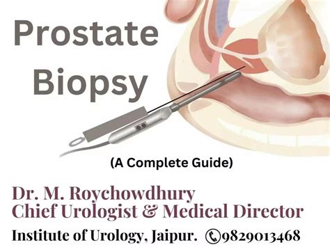 Prostate Biopsy A Complete Guide