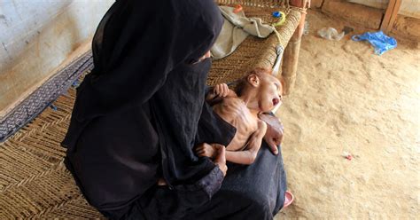 Famine Stalks Yemen As War Drags On And Foreign Aid Wanes The New