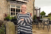 Emmerdale star Lesley Dunlop has her head shaved and it brings back ...
