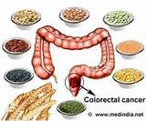 New Colorectal Cancer Treatments