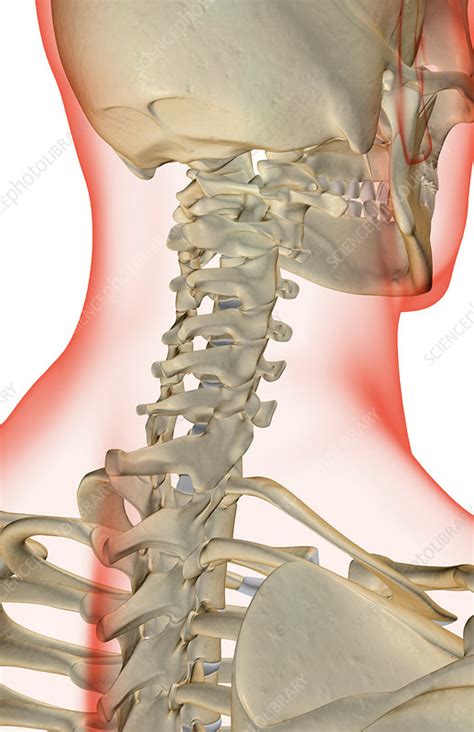 The bones of the neck - Stock Image - F001/6046 - Science Photo Library