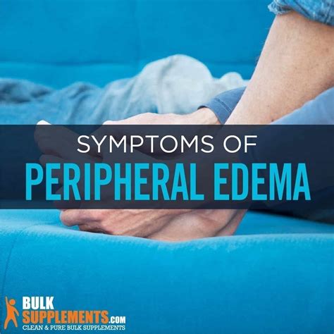 Tablo Read Peripheral Edema Symptoms Causes And Treatment By