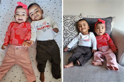 guinness record holders smallest miracle twins born 4 months early defy all odds national