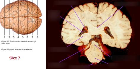 1 Gross Structure Of The Cns Coronal Slices Through The Brain