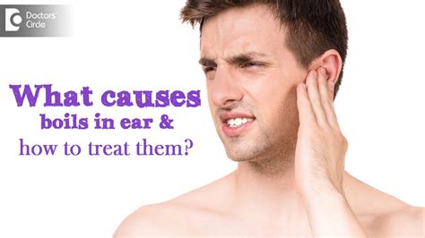 What Causes Boils In Ear And How To Treat Them Dr Satish Babu K