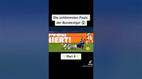 Die Schlimmsten Fouls Der Bundesliga 😱 Shorts Youtube