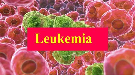 Leukemia Causes Symptom Signs Diagnosis Prognosis And Treatment
