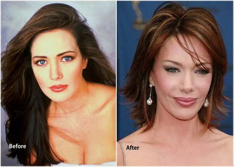 Hunter Tylo Plastic Surgery Before After