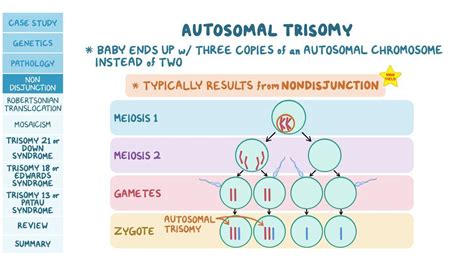 Autosomal Trisomies Pathology Review Osmosis