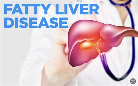 Fatty Liver Disease Or Hepatic Steatosis Slimming Center In Pune