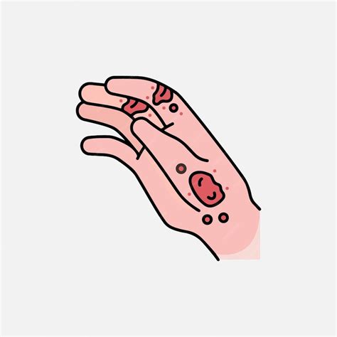 인간의 손 질병 증상 여드름 알레르기 라인 아트에 붉은 발진 프리미엄 벡터