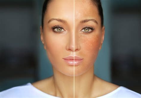 Tips To Restore Your Natural Skin Color Antropologianutricion