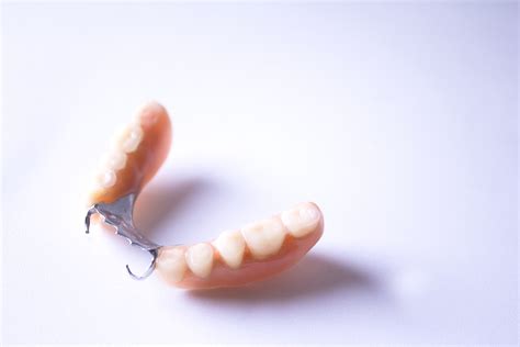 Woodland Hills Dentist Looks At How We Support Partial Dentures ...