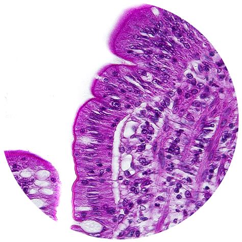 Close Up Of Intestine Epithelium Histology And Histophathology