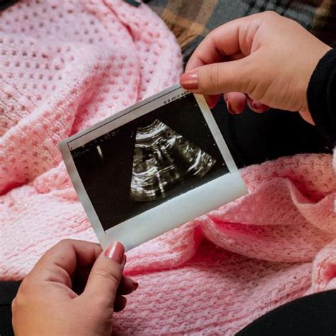 Early Gender Dna Test Sneakpeek