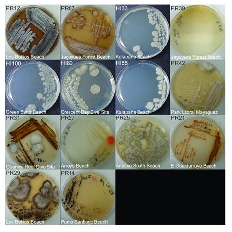 Representative Bacterial Colonies With Different Morphologies Growing