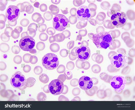 Neutrophil Cell White Blood Cell Peripheral Stock Photo 411399973