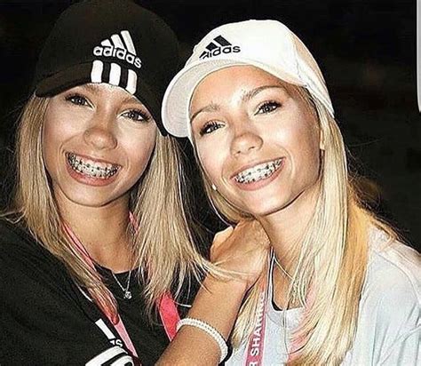 Braces Girls Celebrities With Braces Celebs Amazing Selfies Lisa Or Lena Womens Fashion