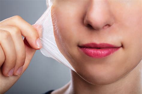 Chemical Peels In Ottawa Expectations Dermis Advanced Skin Care