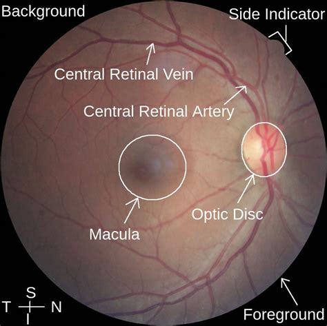Visibility Of Main Anatomical Structures In A Color Fundus Photograph