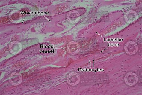 Mammal Joint Transverse Section 250x Woven Bone Bone