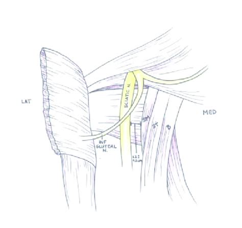 Normal Proximal Hamstring Anatomy The Sciatic Nerve Is 12 ± 02 Cm