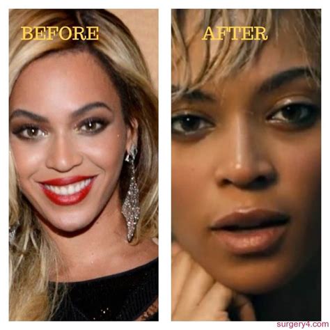 Beyonce Nose Job Photos Before And After ⋆ Surgery4