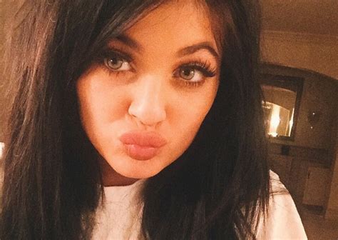 Teenagers Are Sucking Shot Glasses To Get Lips Like Kylie Jenner And The Results Are Catastrophic