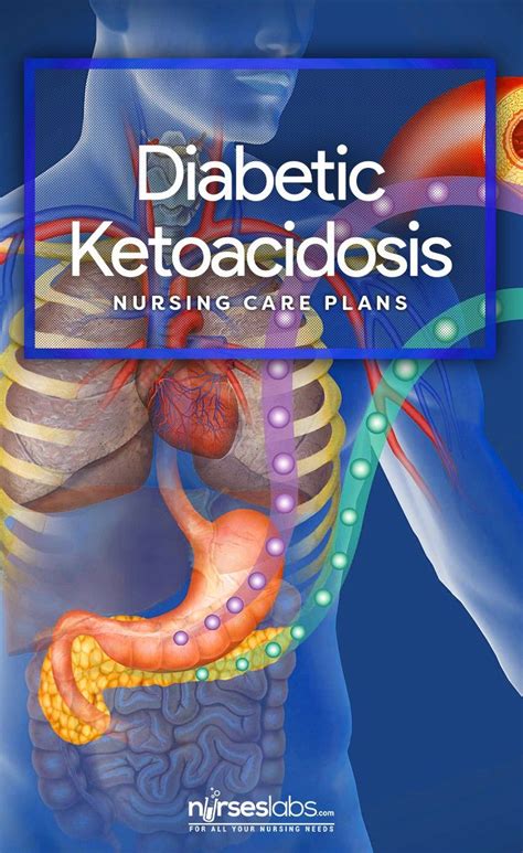 4 Diabetic Ketoacidosis And Hhns Nursing Care Plans Nursing Care Plan