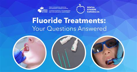 Fluoride Treatments Your Questions Answered